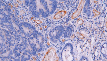 CD105 Antibody