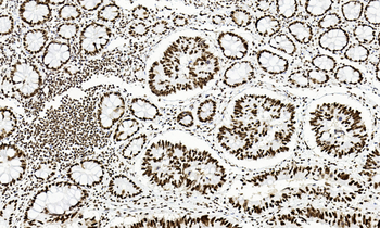 ARID1A Antibody