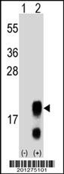 FSHB/FSH Antibody (Center)