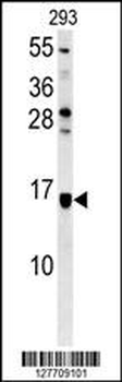 ATXN7L3B Antibody (Center)