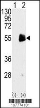 PRMT7 Antibody (C-term)