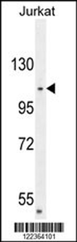 CENPC1 Antibody (Center)