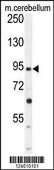 GABBR2 Antibody (C-term)