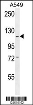 GABBR2 Antibody (C-term)