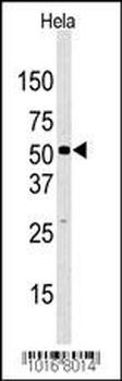 JMJD2D Antibody (C-term)