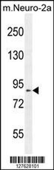 DDX11 Antibody (Center)