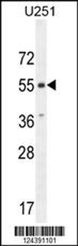 CMKOR1 Antibody (C-term)