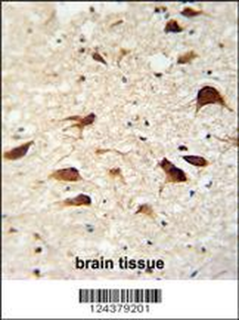 CB018 Antibody (C-term)