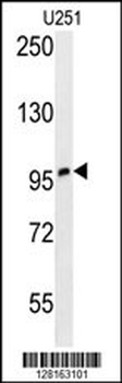 ZNF197 Antibody (N-term)