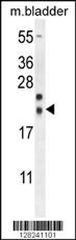 NXNL2 Antibody (Center)