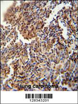 HFM1 Antibody (C-term)