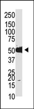 Mouse Dnmt2 Antibody (N-term)
