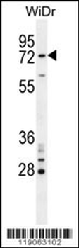 BARD1 Antibody (N-term)