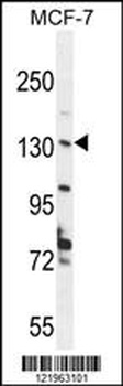UPF2 Antibody (Center)