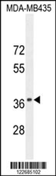 CADM1 Antibody (N-term)