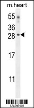 CLDN6 Antibody (Center)