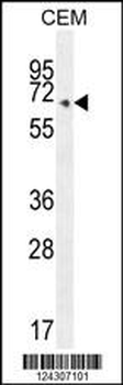 COX10 Antibody (C-term)