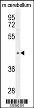 PTOV1 Antibody (N-term)