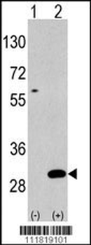 UBTD1 Antibody (C-term G195)