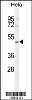 SMYD1 Antibody (C-term)