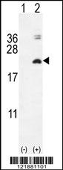 IL17F Antibody (N-term)