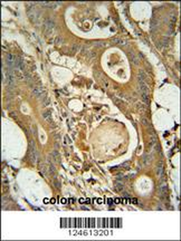 GCNT3 Antibody (C-term)