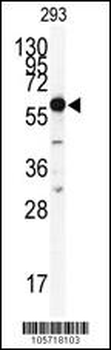 HDAC2 Antibody (C-term)
