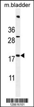 ACN9 Antibody (N-term)