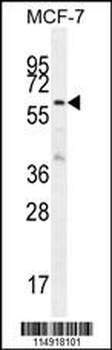 KARS Antibody (N-term)