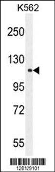 TDRD1 Antibody (C-term)