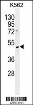 TRMT2B Antibody (N-term)