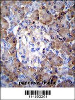 TIMP1 Antibody (C-term)