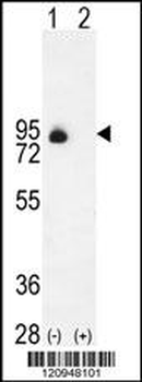 ENG Antibody (Center)