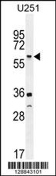 TNFRSF1A Antibody (N-term)