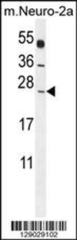 POLR2J Antibody (C-Term)