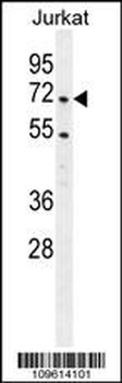 PRMT4 Antibody(Center)