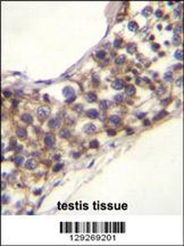 PNLDC1 Antibody (C-term)