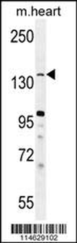 JHDM2b Antibody (C-term)