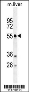 ATG4D Antibody (N-term)