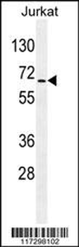 RBM14 Antibody (C-term)