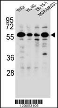 FOXC2 Antibody (Center P198)