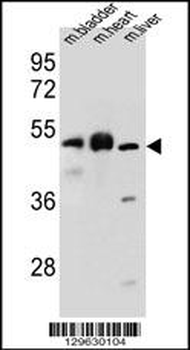 BTBD17 Antibody (C-term)
