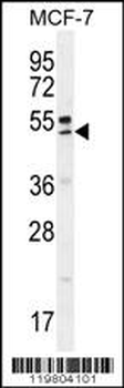 QTRTD1 Antibody (C-term)