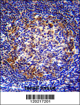PAX5 Antibody (Center)