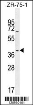 JUNB Antibody (Center)