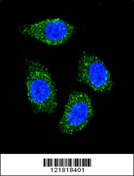 TNFSF15 Antibody (Center)