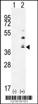 TNFSF15 Antibody (Center)
