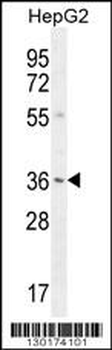 VSIG1 Antibody (C-term)
