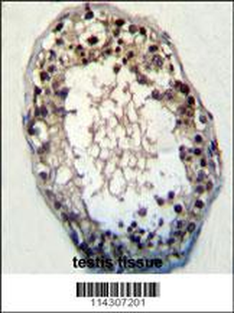 JHDM2a Antibody (N-term)