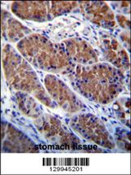 OTOP1 Antibody (Center)